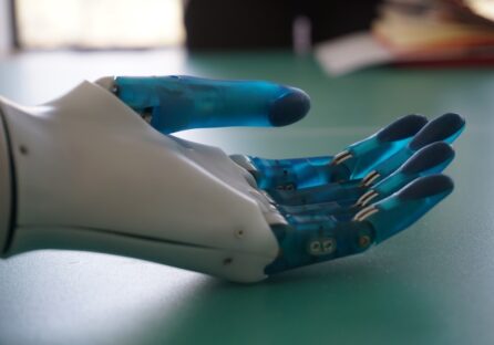 Український стартап Esper Bionics, який розробляє роборуку, залучив інвестиції від SMRK